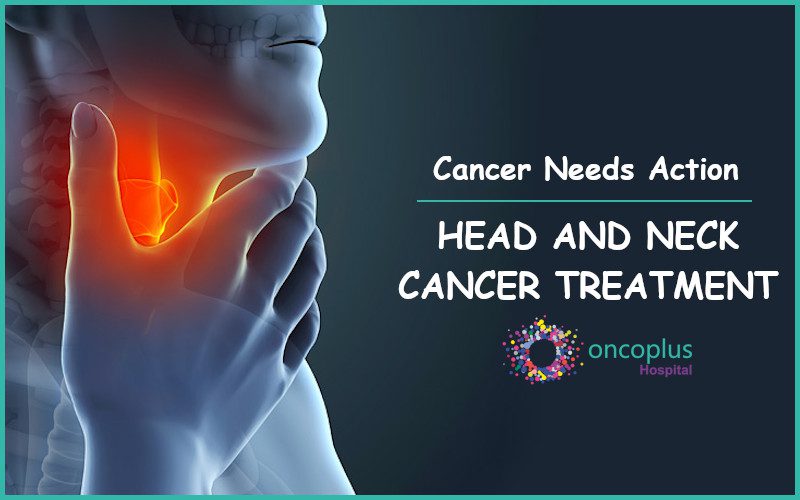 Head And Neck Cancer Awareness Heres How To Stay Aware 3145