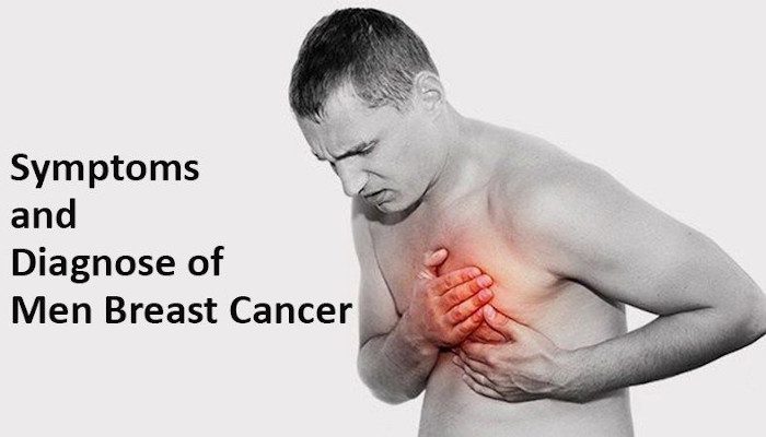 Men With Breast Cancer Symptoms Causes Management